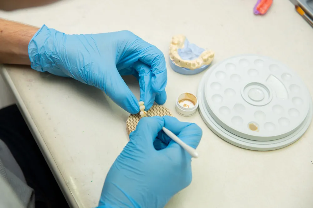 Odontotecnico che applica la ceramica su un ponte, accanto al modello in gesso e alla scala colori