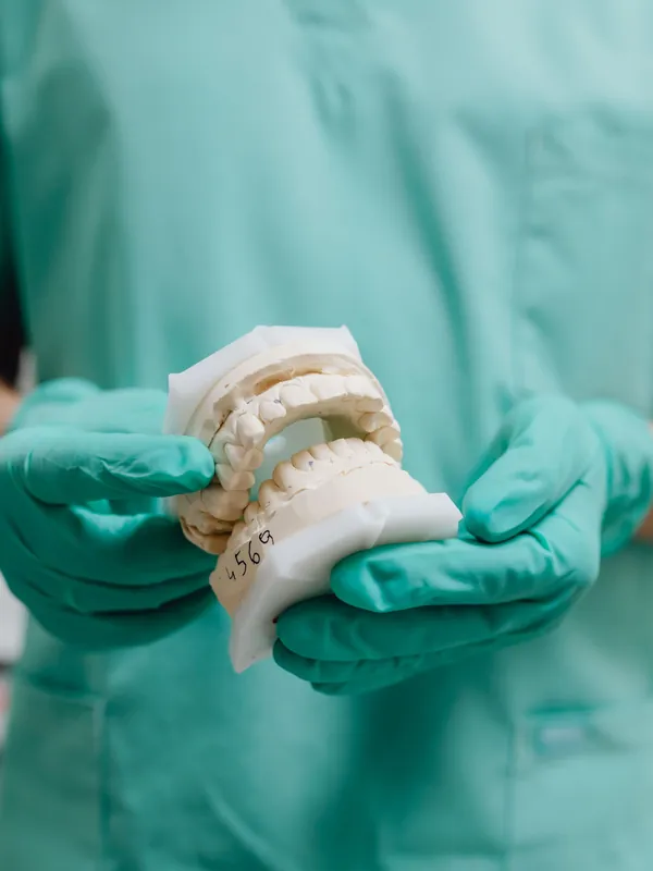 Mani con guanti che reggono il modello in gesso di un'arcata dentale numerato a mano